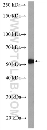 CAP1 Antibody in Western Blot (WB)