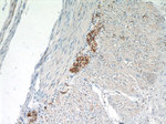 VIP Antibody in Immunohistochemistry (Paraffin) (IHC (P))