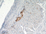 VIP Antibody in Immunohistochemistry (Paraffin) (IHC (P))