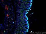 VIP Antibody in Immunohistochemistry (PFA fixed) (IHC (PFA))