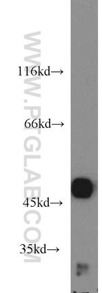 Carboxypeptidase A3 Antibody in Western Blot (WB)