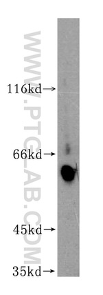 GAL3ST4 Antibody in Western Blot (WB)