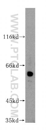 GAL3ST4 Antibody in Western Blot (WB)