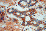 MRPL13 Antibody in Immunohistochemistry (Paraffin) (IHC (P))