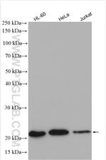 MRPL13 Antibody in Western Blot (WB)