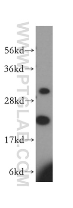 MRPL13 Antibody in Western Blot (WB)