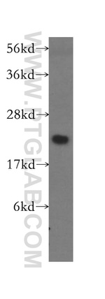 MRPL13 Antibody in Western Blot (WB)