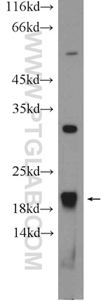 MRPL13 Antibody in Western Blot (WB)