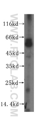 SDSL Antibody in Western Blot (WB)