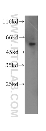 SDSL Antibody in Western Blot (WB)