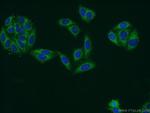 ATP13A1 Antibody in Immunocytochemistry (ICC/IF)