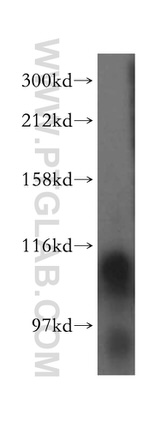 ATP13A1 Antibody in Western Blot (WB)