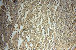 PRKCDBP Antibody in Immunohistochemistry (Paraffin) (IHC (P))