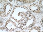 FAF2 Antibody in Immunohistochemistry (Paraffin) (IHC (P))