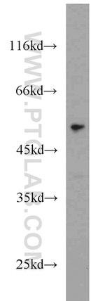 FAF2 Antibody in Western Blot (WB)