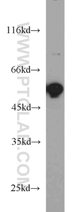 FAF2 Antibody in Western Blot (WB)