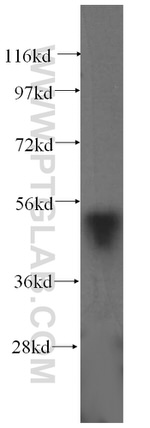 FAF2 Antibody in Western Blot (WB)