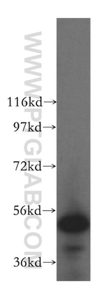 FAF2 Antibody in Western Blot (WB)