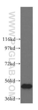 FAF2 Antibody in Western Blot (WB)