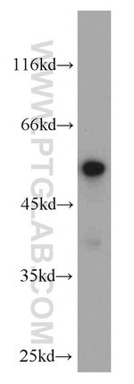 FAF2 Antibody in Western Blot (WB)