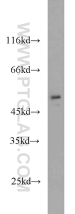 FAF2 Antibody in Western Blot (WB)