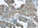 GGCT Antibody in Immunohistochemistry (Paraffin) (IHC (P))