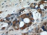 GGCT Antibody in Immunohistochemistry (Paraffin) (IHC (P))