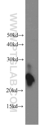 GGCT Antibody in Western Blot (WB)