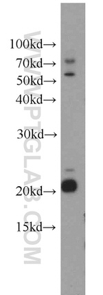 GGCT Antibody in Western Blot (WB)