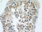 RGS14 Antibody in Immunohistochemistry (Paraffin) (IHC (P))