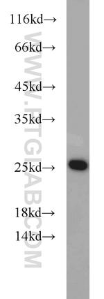 GADD45GIP1 Antibody in Western Blot (WB)