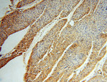 TSR2 Antibody in Immunohistochemistry (Paraffin) (IHC (P))