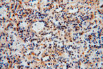 TSR2 Antibody in Immunohistochemistry (Paraffin) (IHC (P))