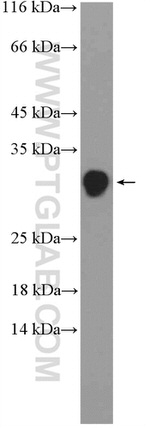 TSR2 Antibody in Western Blot (WB)