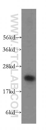 TSR2 Antibody in Western Blot (WB)