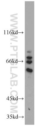 CEP63 Antibody in Western Blot (WB)