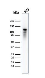 Drebrin 1 (DBN1) Antibody in Western Blot (WB)