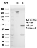 Drebrin 1 (DBN1) Antibody in SDS-PAGE (SDS-PAGE)