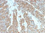 Drebrin 1 (DBN1) Antibody in Immunohistochemistry (Paraffin) (IHC (P))