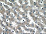 GCC1 Antibody in Immunohistochemistry (Paraffin) (IHC (P))