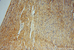 ATP6V1C2 Antibody in Immunohistochemistry (Paraffin) (IHC (P))