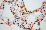 ATP6V1C2 Antibody in Immunohistochemistry (Paraffin) (IHC (P))