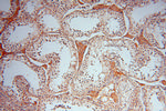 ATP6V1C2 Antibody in Immunohistochemistry (Paraffin) (IHC (P))