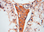 ATP6V1C2 Antibody in Immunohistochemistry (Paraffin) (IHC (P))