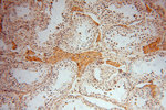 DHRS1 Antibody in Immunohistochemistry (Paraffin) (IHC (P))