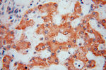 DHRS1 Antibody in Immunohistochemistry (Paraffin) (IHC (P))