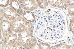 DHRS1 Antibody in Immunohistochemistry (Paraffin) (IHC (P))