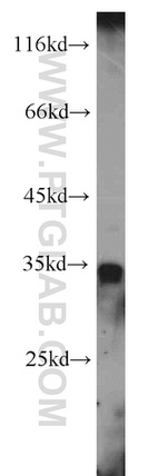 DHRS1 Antibody in Western Blot (WB)