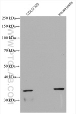 DHRS1 Antibody in Western Blot (WB)