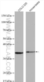 DHRS1 Antibody in Western Blot (WB)